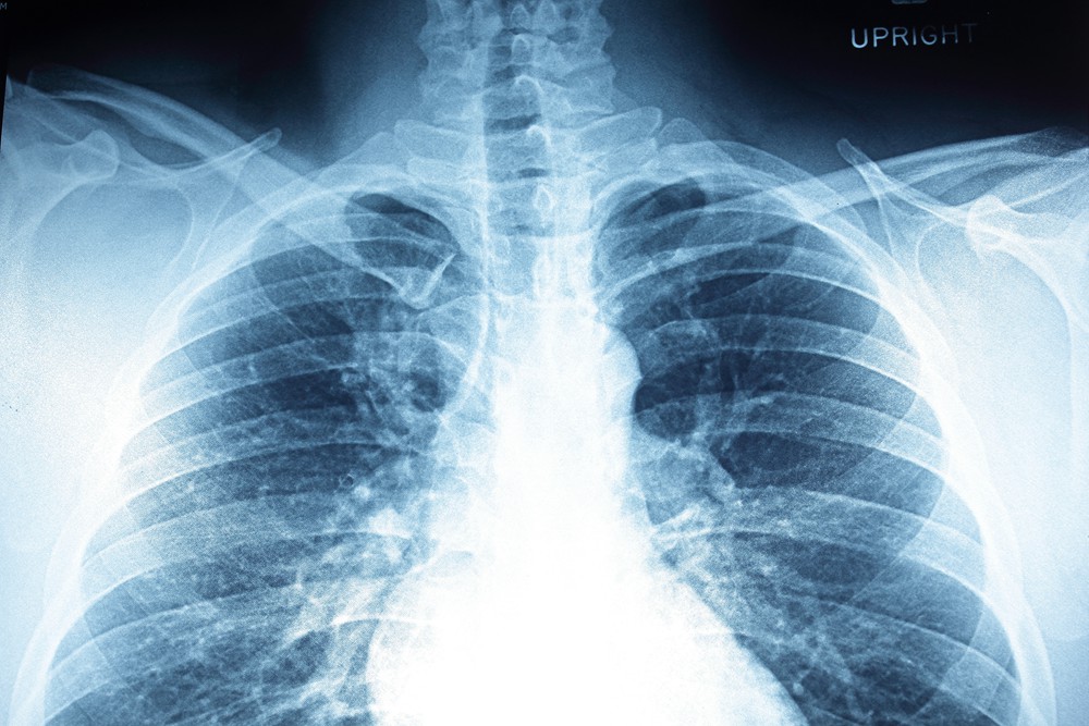 Medical Films Application of HONGSAM Imaging Inks
